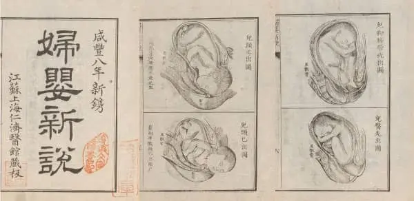 葉德輝收藏《婦嬰新說》